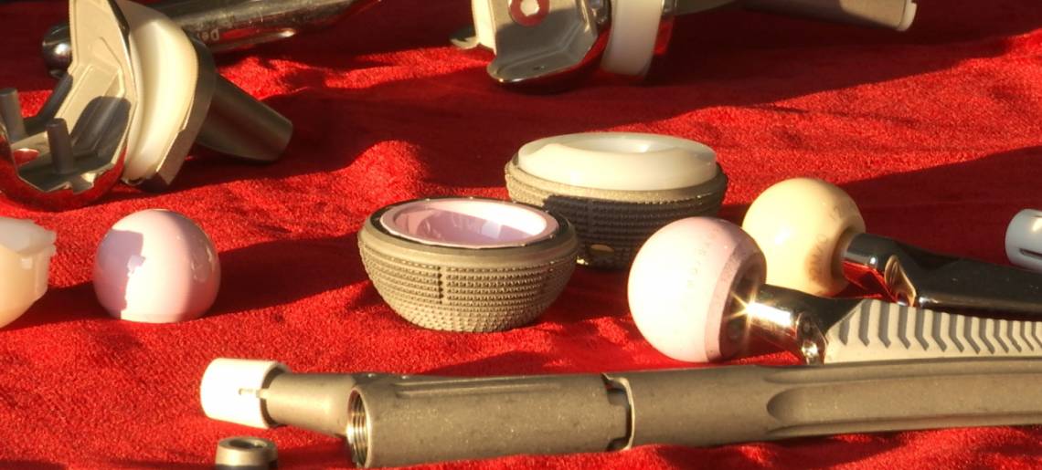 Gelenkig bleiben: Gelenke Clip 6a34f79a